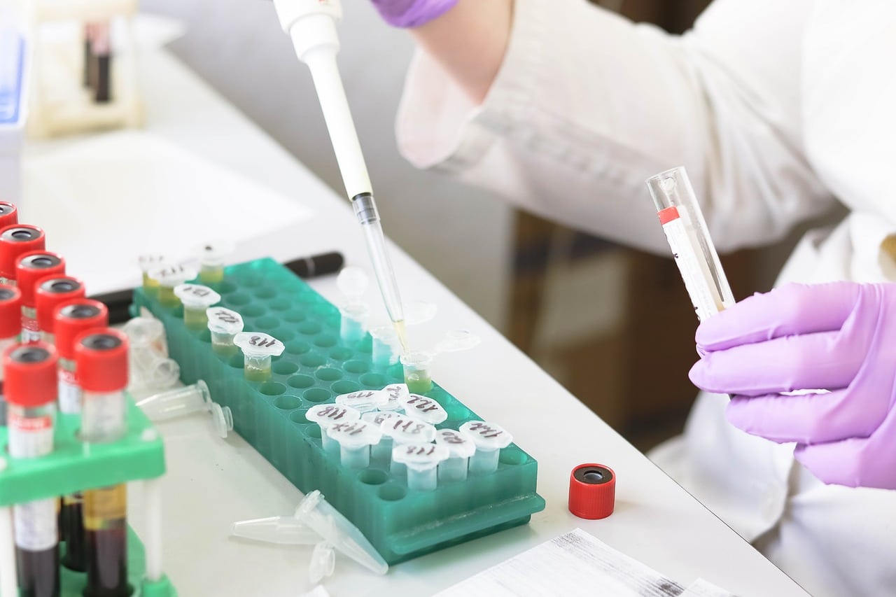 laboratory-testing-using-medical-pipette-to-conduct-research